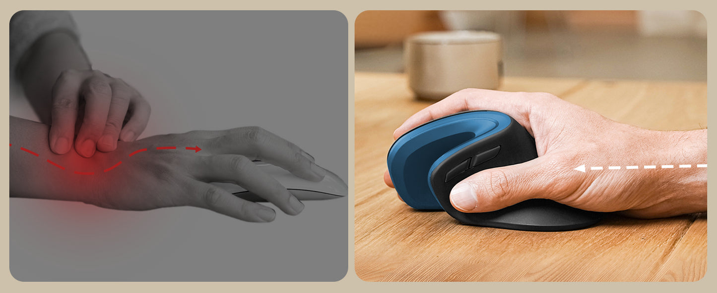 ProtoArc EM11 Vertical Mouse – Ergonomic, Rechargeable, BT & 2.4GHz